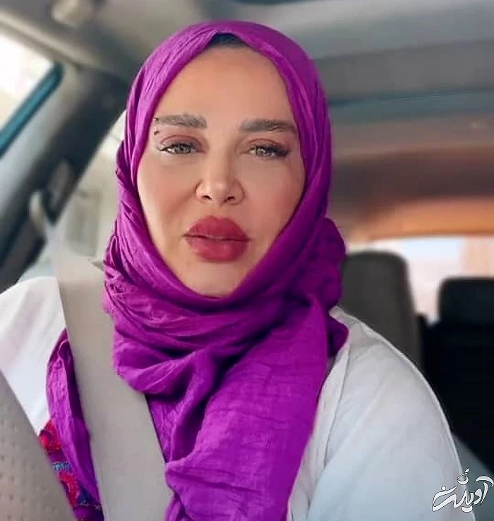 جراحی پلک بهاره رهنما جراحی پلک